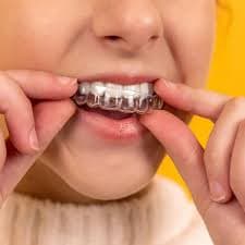 How Ceramic Braces Work to Straighten Your Smile
